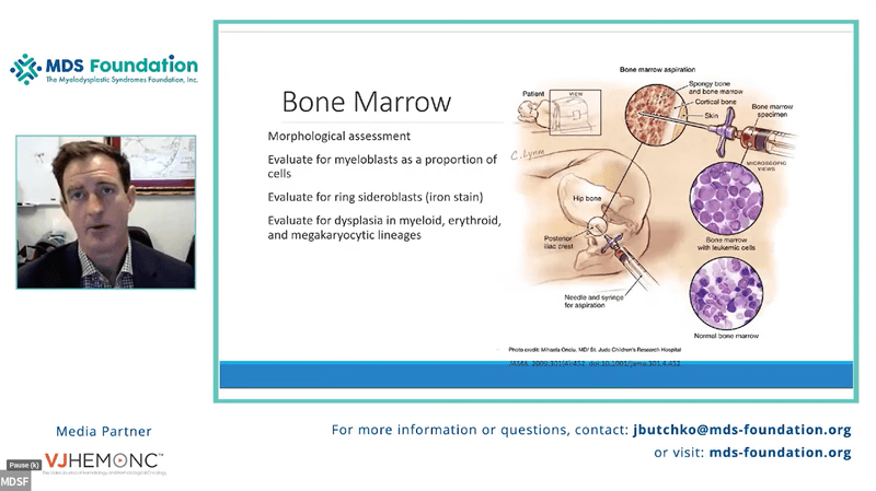 Updates on MDS Classifications