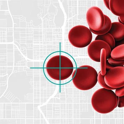 Precision Hematology in Myelodysplastic Syndromes